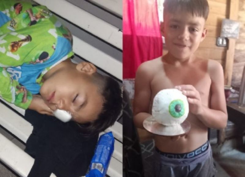 En busca de una prótesis para Laureano: familia contrarreloj antes del inicio de las clases